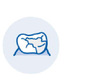 虫歯がやや大きい場合の修復治療④