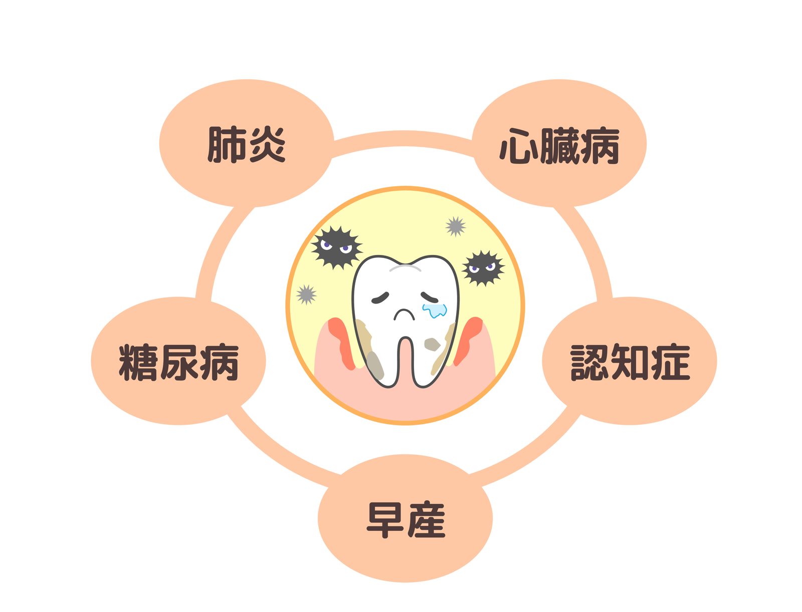 歯周病と全身の健康との関わり
